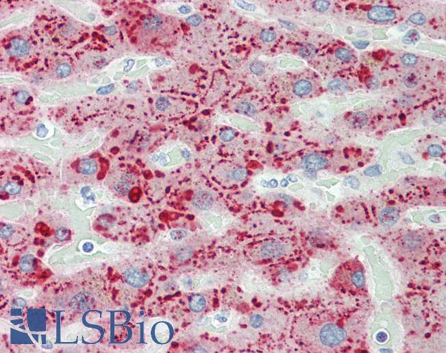 SAA1 / SAA / Serum Amyloid A Antibody - Anti-SAA1 / SAA / Serum Amyloid A antibody IHC staining of human liver. Immunohistochemistry of formalin-fixed, paraffin-embedded tissue after heat-induced antigen retrieval. Antibody dilution 1:50.