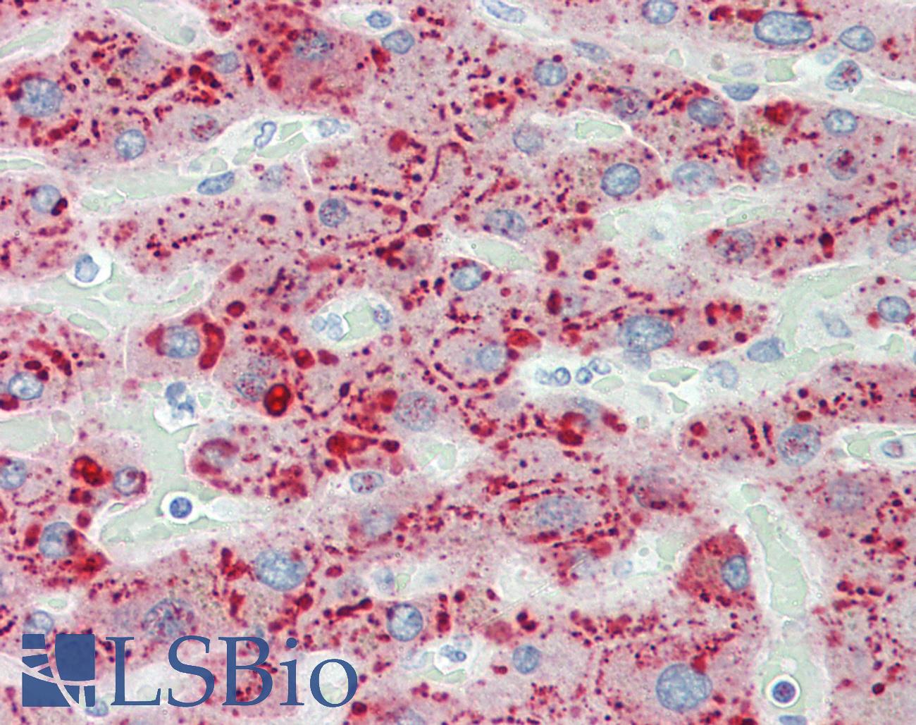 SAA1 / SAA / Serum Amyloid A Antibody - Anti-SAA1 / SAA / Serum Amyloid A antibody IHC staining of human liver. Immunohistochemistry of formalin-fixed, paraffin-embedded tissue after heat-induced antigen retrieval. Antibody dilution 1:50.