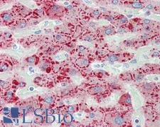 SAA1 / SAA / Serum Amyloid A Antibody - Anti-SAA1 / SAA / Serum Amyloid A antibody IHC staining of human liver. Immunohistochemistry of formalin-fixed, paraffin-embedded tissue after heat-induced antigen retrieval. Antibody dilution 1:50.