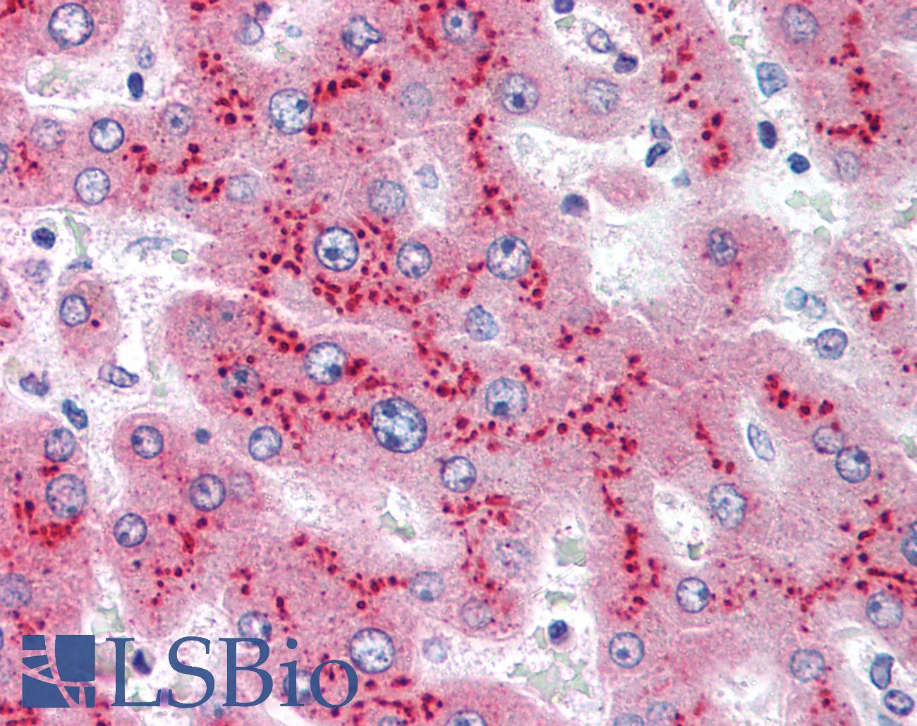 SAA1 / SAA / Serum Amyloid A Antibody - Anti-SAA1 / Serum Amyloid A antibody IHC of human liver. Immunohistochemistry of formalin-fixed, paraffin-embedded tissue after heat-induced antigen retrieval. Antibody concentration 5 ug/ml.