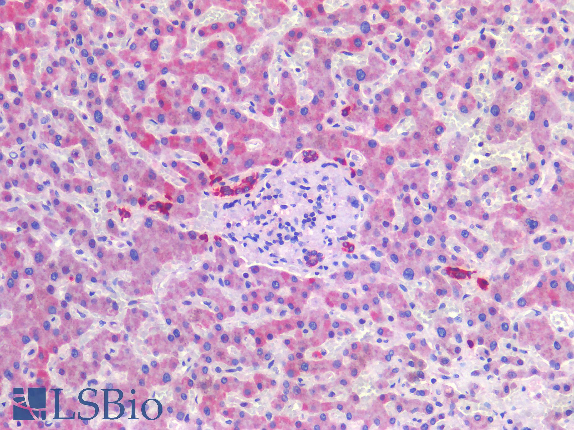 SCD1 / SCD Antibody - Human Liver: Formalin-Fixed, Paraffin-Embedded (FFPE)