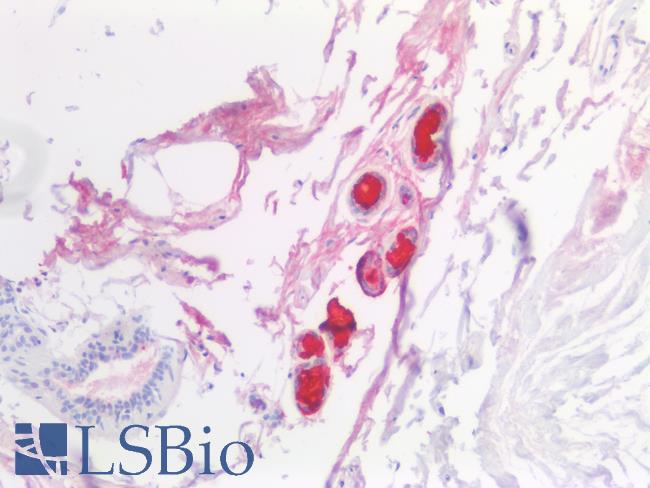 SCGB1D2 / Lipophilin B Antibody - Human Breast: Formalin-Fixed, Paraffin-Embedded (FFPE)