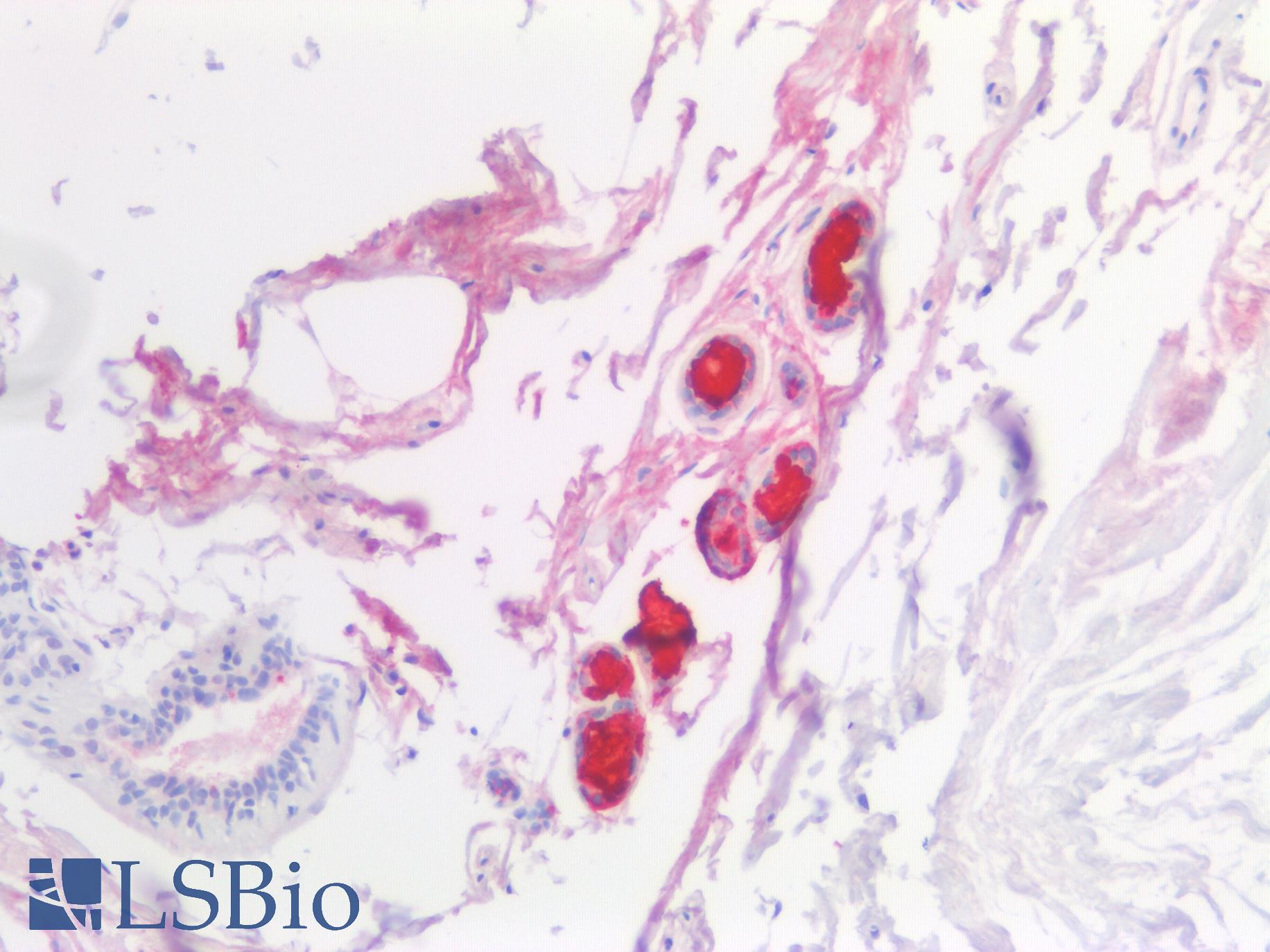 SCGB1D2 / Lipophilin B Antibody - Human Breast: Formalin-Fixed, Paraffin-Embedded (FFPE)
