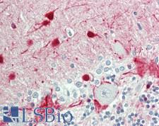 SCGN / Secretagogin Antibody - Human Brain, Cerebellum: Formalin-Fixed, Paraffin-Embedded (FFPE)