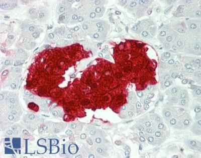 SCGN / Secretagogin Antibody - Human Pancreas, islets of Langerhans: Formalin-Fixed, Paraffin-Embedded (FFPE)