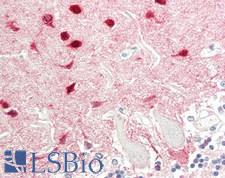 SCGN / Secretagogin Antibody - Human Brain, Cerebellum: Formalin-Fixed, Paraffin-Embedded (FFPE)