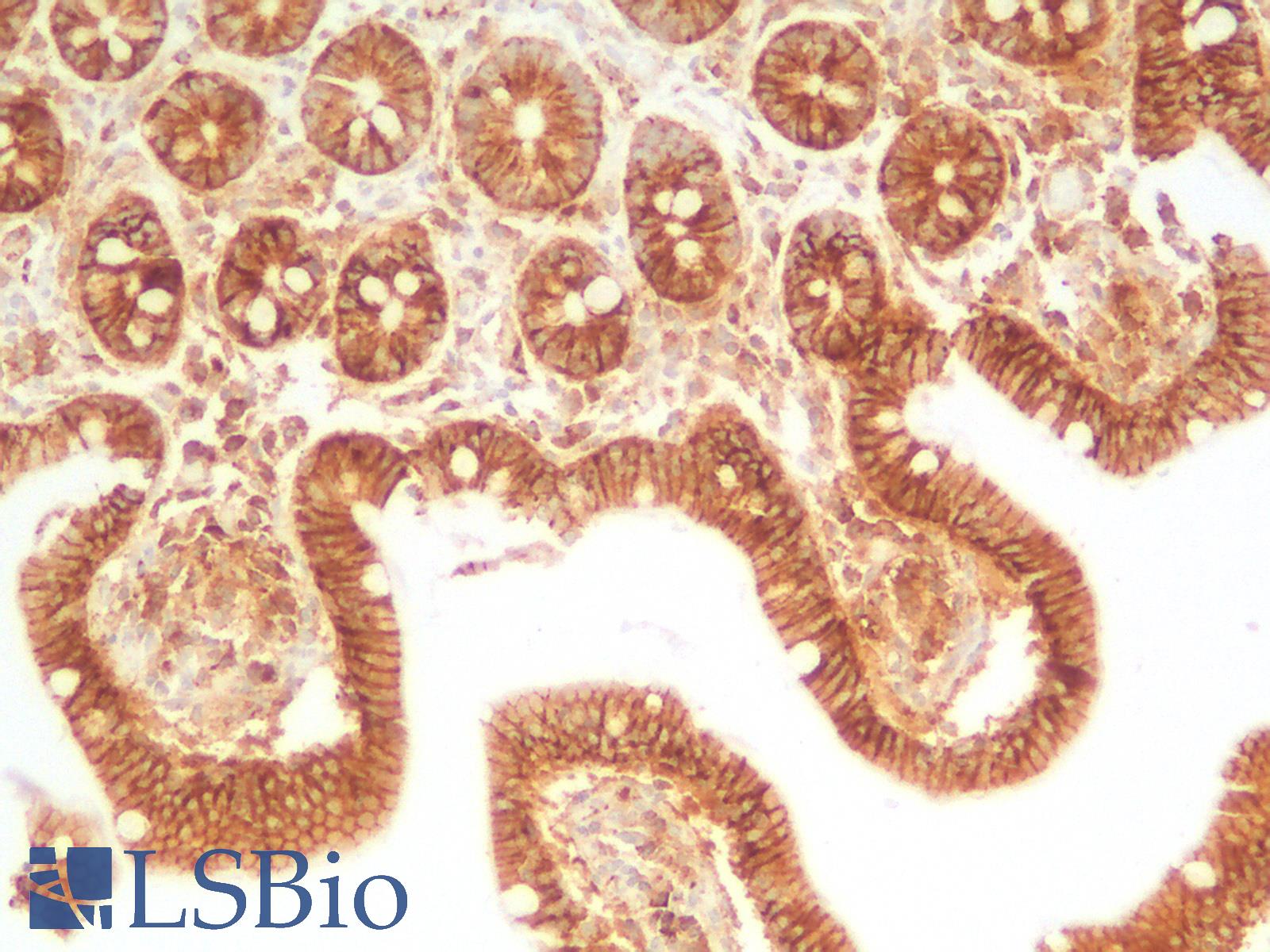 SDC1 / Syndecan 1 / CD138 Antibody - Human Small Intestine: Formalin-Fixed, Paraffin-Embedded (FFPE)