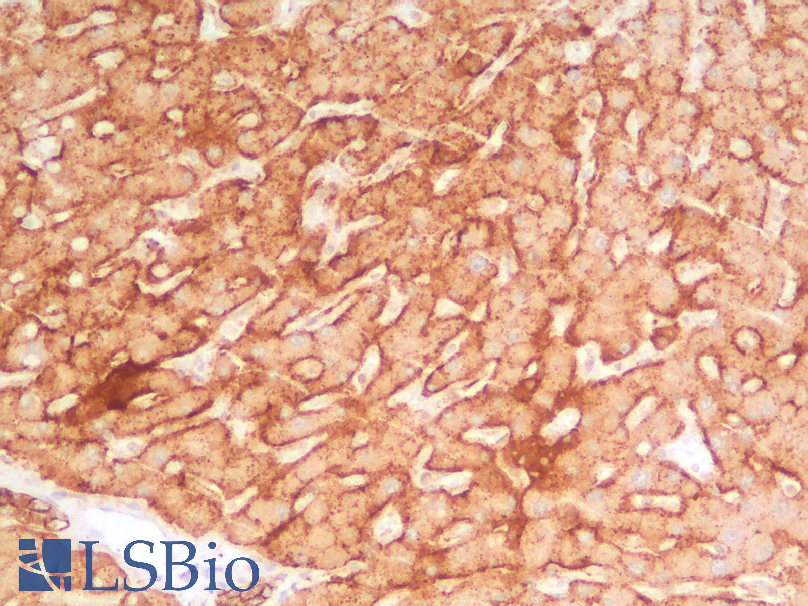 SDC1 / Syndecan 1 / CD138 Antibody - Human Liver: Formalin-Fixed, Paraffin-Embedded (FFPE)