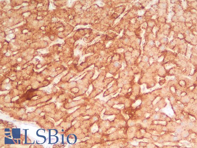 SDC1 / Syndecan 1 / CD138 Antibody - Human Liver: Formalin-Fixed, Paraffin-Embedded (FFPE)
