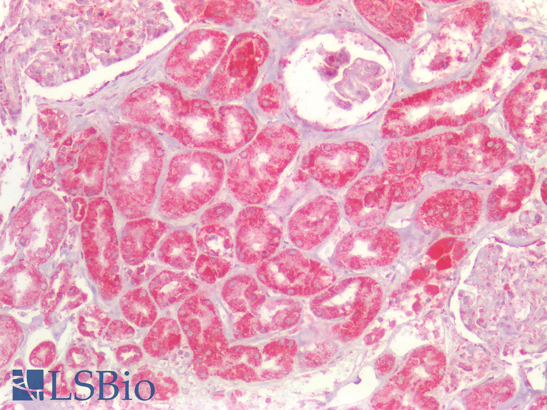 SDHB Antibody - Human Kidney: Formalin-Fixed, Paraffin-Embedded (FFPE)