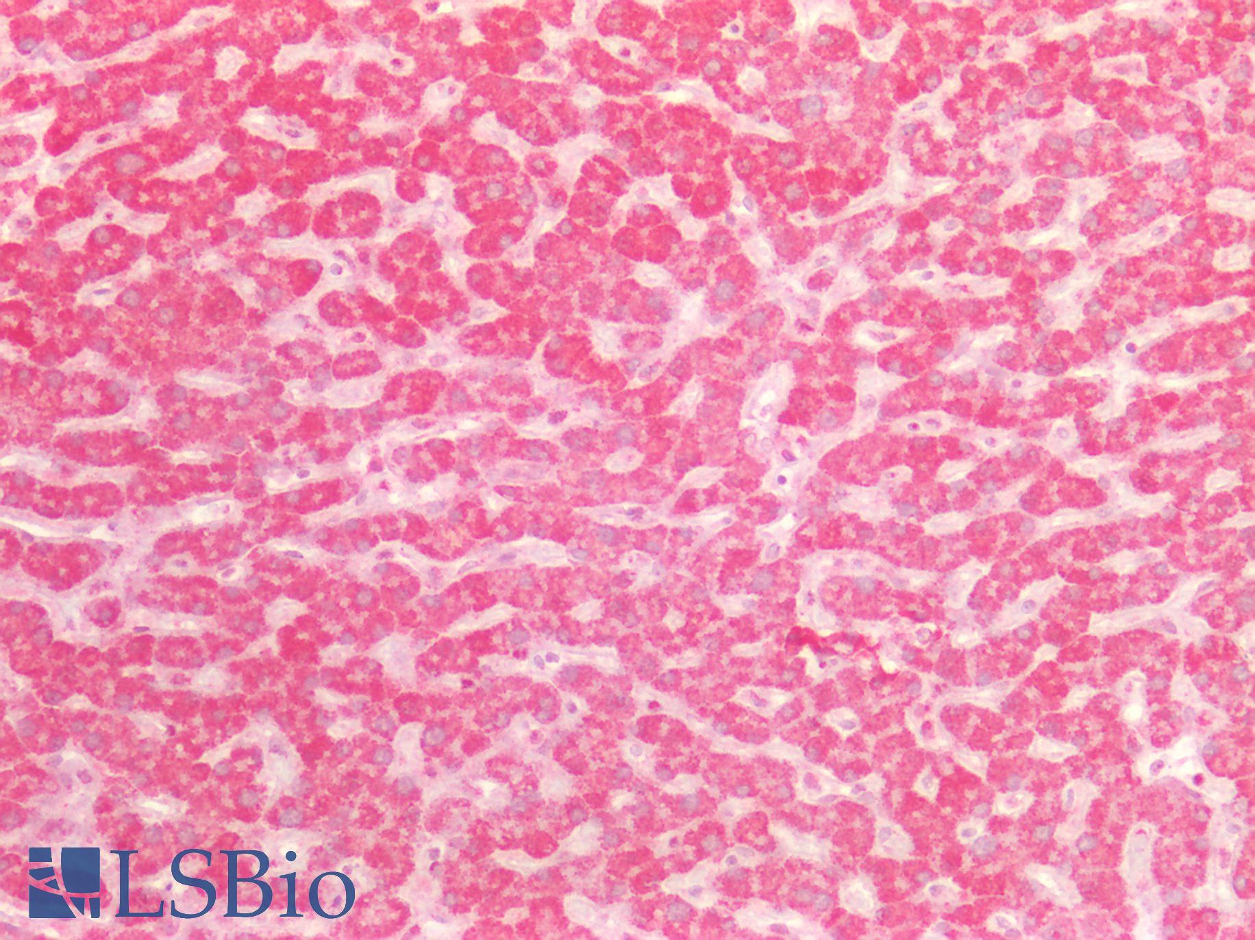 SDHB Antibody - Human Liver: Formalin-Fixed, Paraffin-Embedded (FFPE)