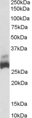 SDHB Antibody - Antibody (0.03 ug/ml) staining of Human Liver lysate (35 ug protein in RIPA buffer). Primary incubation was 1 hour. Detected by chemiluminescence.