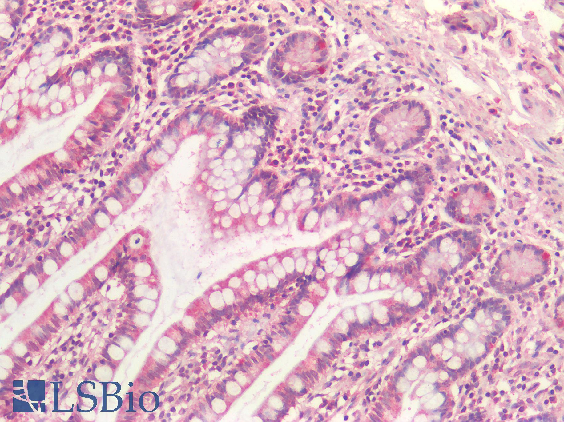 SDHB Antibody - Human Small Intestine: Formalin-Fixed, Paraffin-Embedded (FFPE)