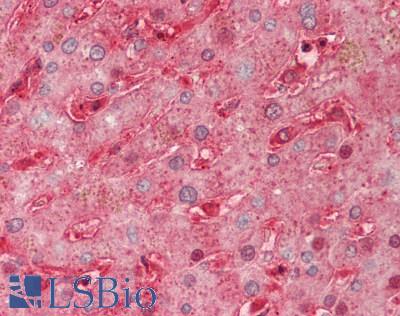 SEMA3A / Semaphorin 3A Antibody - Human Liver: Formalin-Fixed, Paraffin-Embedded (FFPE).  This image was taken for the unconjugated form of this product. Other forms have not been tested.