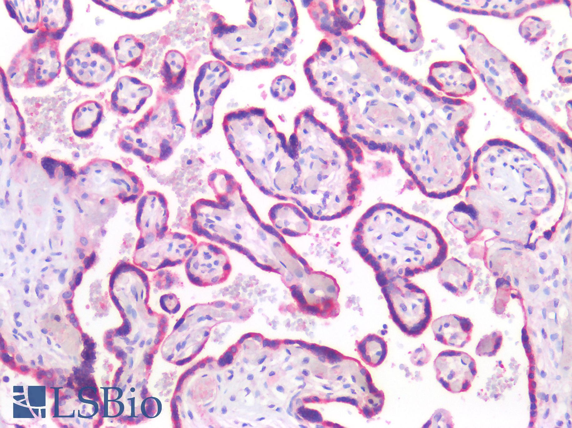 SEMA3B / SemA Antibody - Human Placenta: Formalin-Fixed, Paraffin-Embedded (FFPE)
