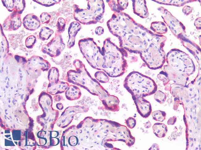 SEMA3B / SemA Antibody - Human Placenta: Formalin-Fixed, Paraffin-Embedded (FFPE)