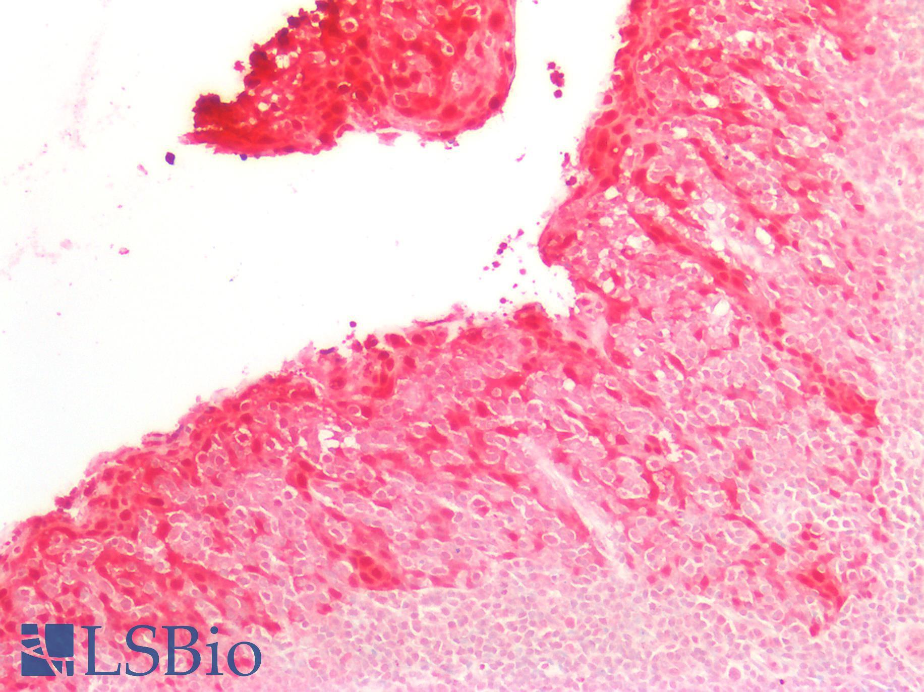 SERPINB5 / Maspin Antibody - Human Tonsil: Formalin-Fixed, Paraffin-Embedded (FFPE)