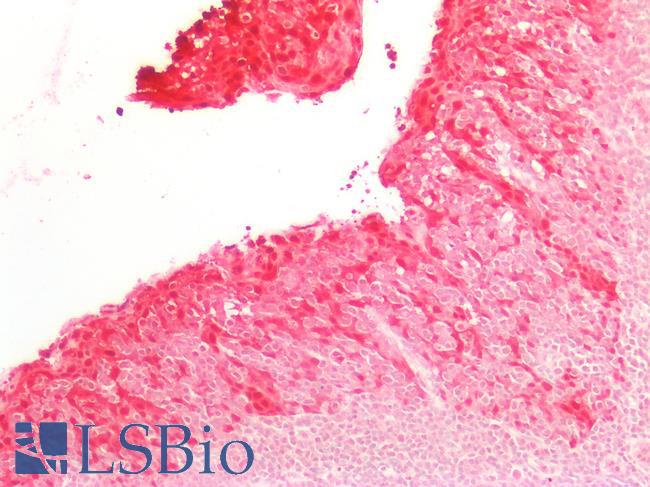 SERPINB5 / Maspin Antibody - Human Tonsil: Formalin-Fixed, Paraffin-Embedded (FFPE)