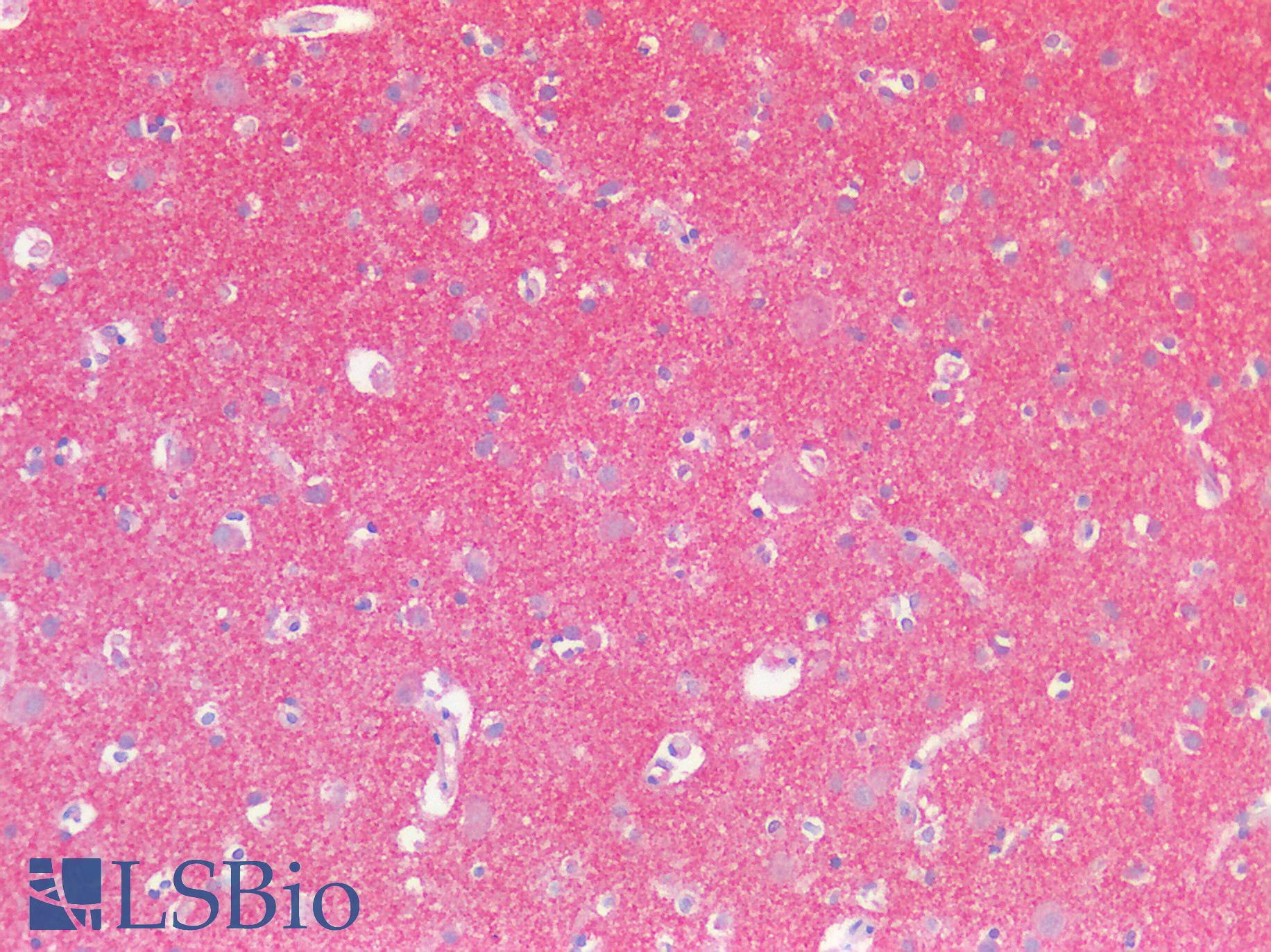 SERPINB7 / MEGSIN Antibody - Human Brain, Cortex: Formalin-Fixed, Paraffin-Embedded (FFPE)