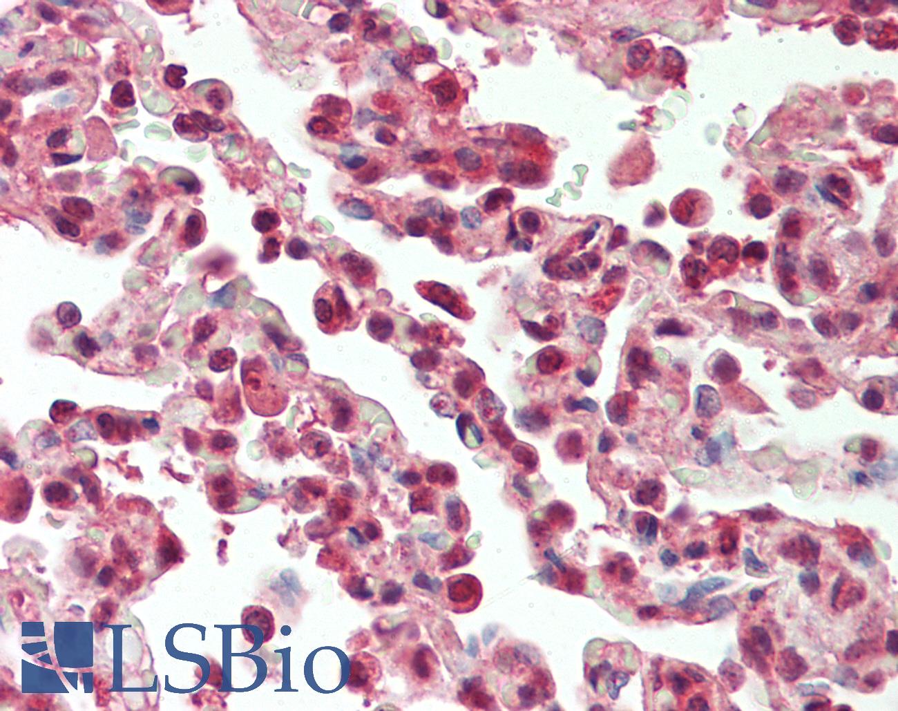 SF1 Antibody - Anti-SF1 antibody IHC staining of human lung alveoli, Type 2 pneumocytes. Immunohistochemistry of formalin-fixed, paraffin-embedded tissue after heat-induced antigen retrieval. Antibody concentration 10 ug/ml.  This image was taken for the unconjugated form of this product. Other forms have not been tested.