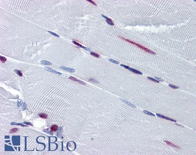 SF1 Antibody - Anti-SF1 antibody IHC of human skeletal muscle. Immunohistochemistry of formalin-fixed, paraffin-embedded tissue after heat-induced antigen retrieval. Antibody concentration 5 ug/ml.