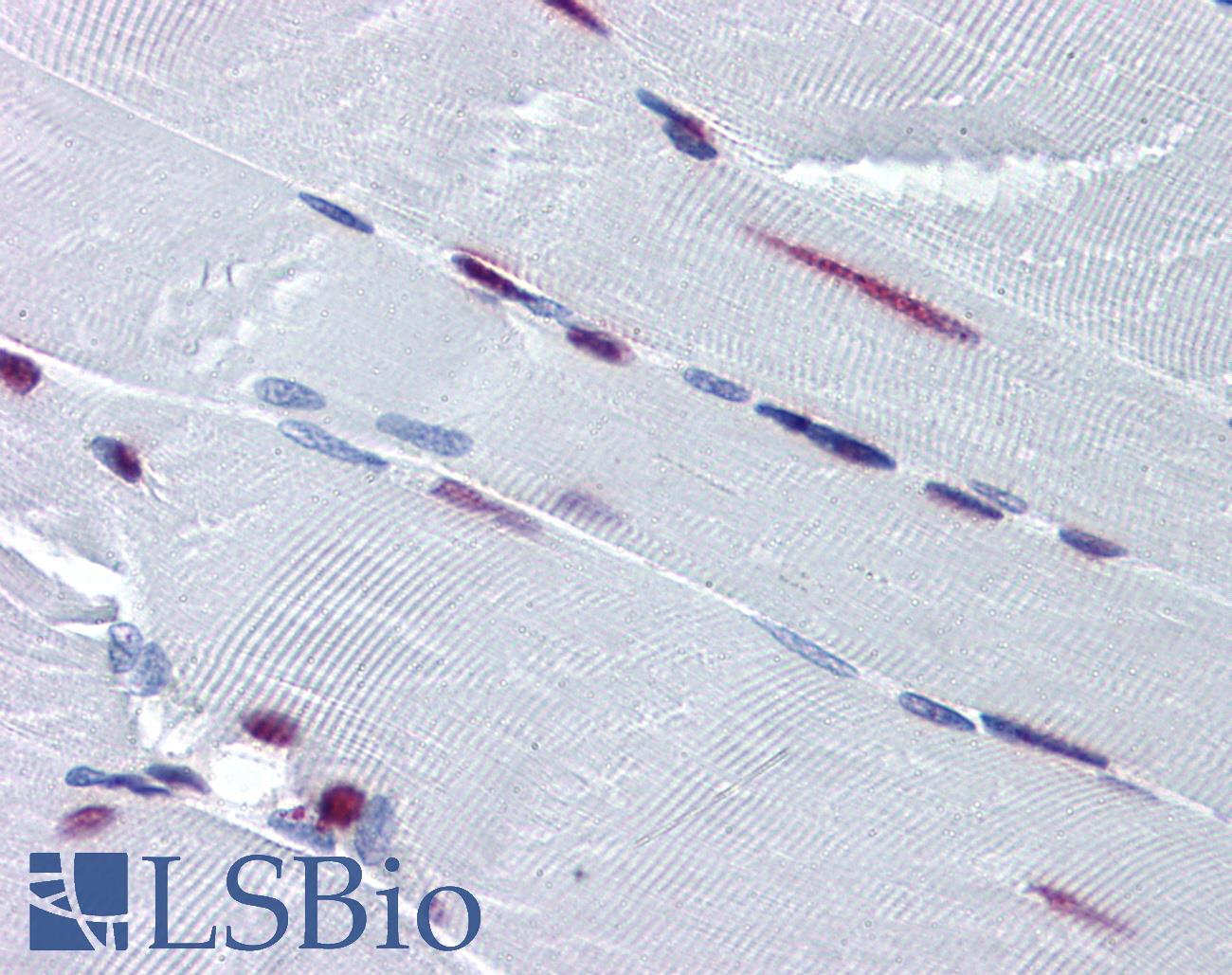 SF1 Antibody - Anti-SF1 antibody IHC of human skeletal muscle. Immunohistochemistry of formalin-fixed, paraffin-embedded tissue after heat-induced antigen retrieval. Antibody concentration 5 ug/ml.