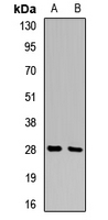 SFN / Stratifin / 14-3-3 Sigma Antibody