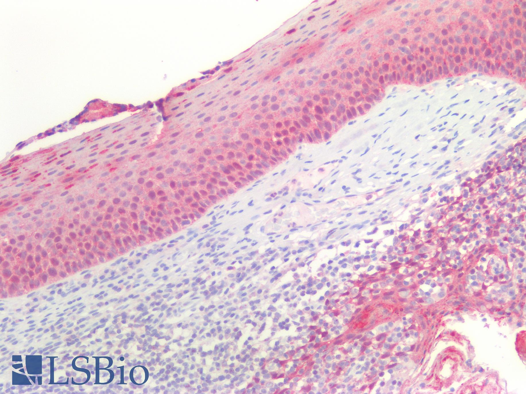 SFN / Stratifin / 14-3-3 Sigma Antibody - Human Tonsil, Squamous: Formalin-Fixed, Paraffin-Embedded (FFPE)