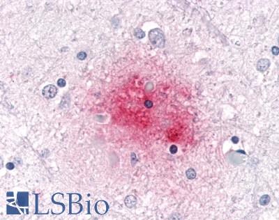 SGK3 Antibody - Brain, Alzheimer's, senile plaques