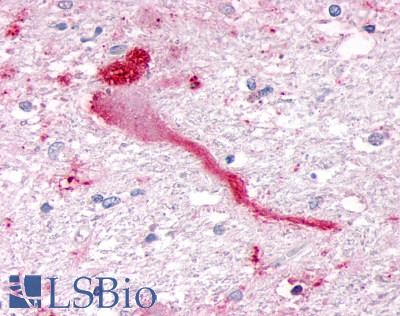 SGK3 Antibody - Brain, Substantia nigra, nonpigmented neuron