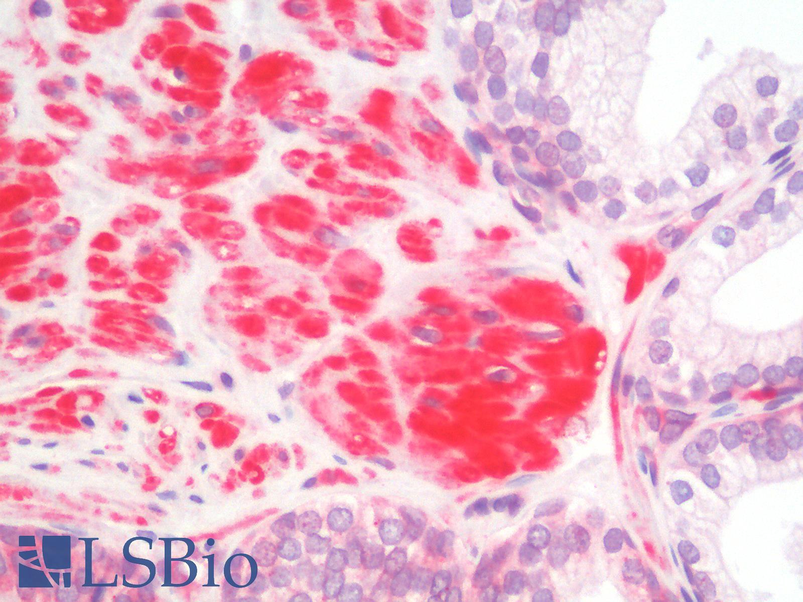 SIAH2 Antibody - Human Prostate: Formalin-Fixed, Paraffin-Embedded (FFPE)