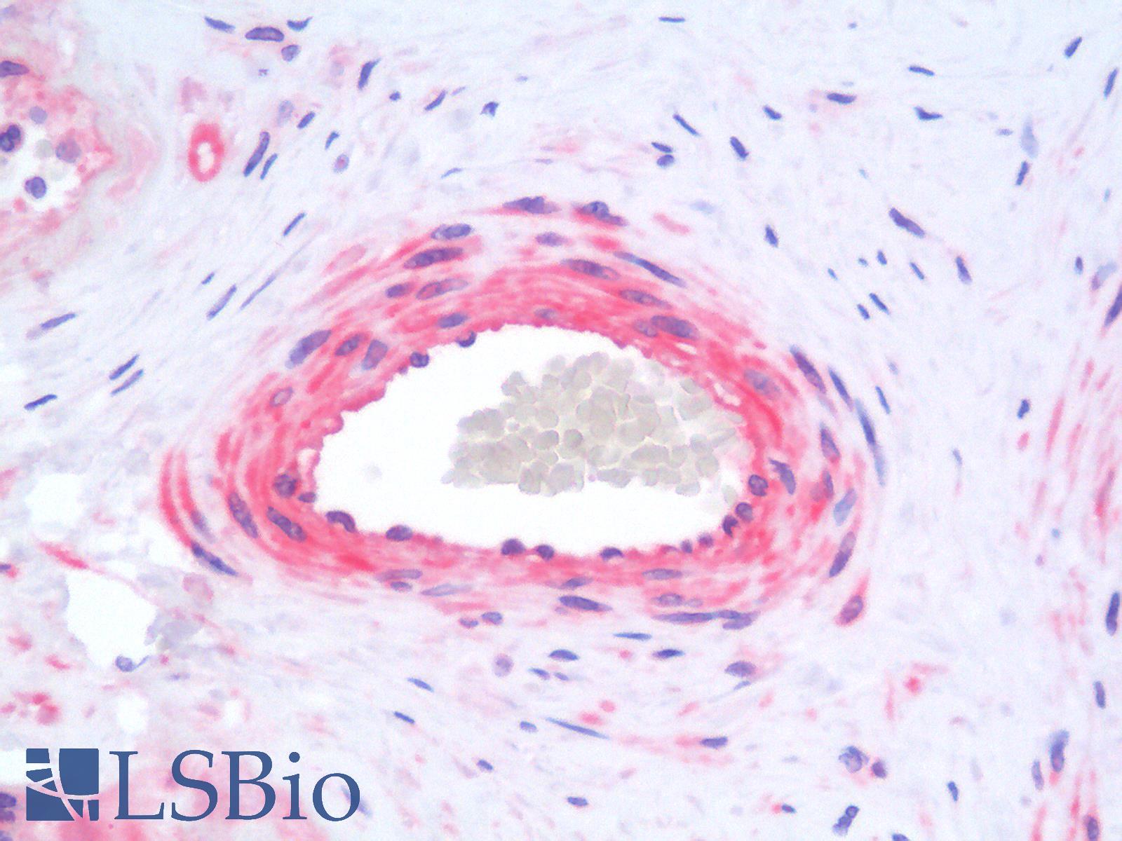 SIAH2 Antibody - Human Placenta: Formalin-Fixed, Paraffin-Embedded (FFPE)