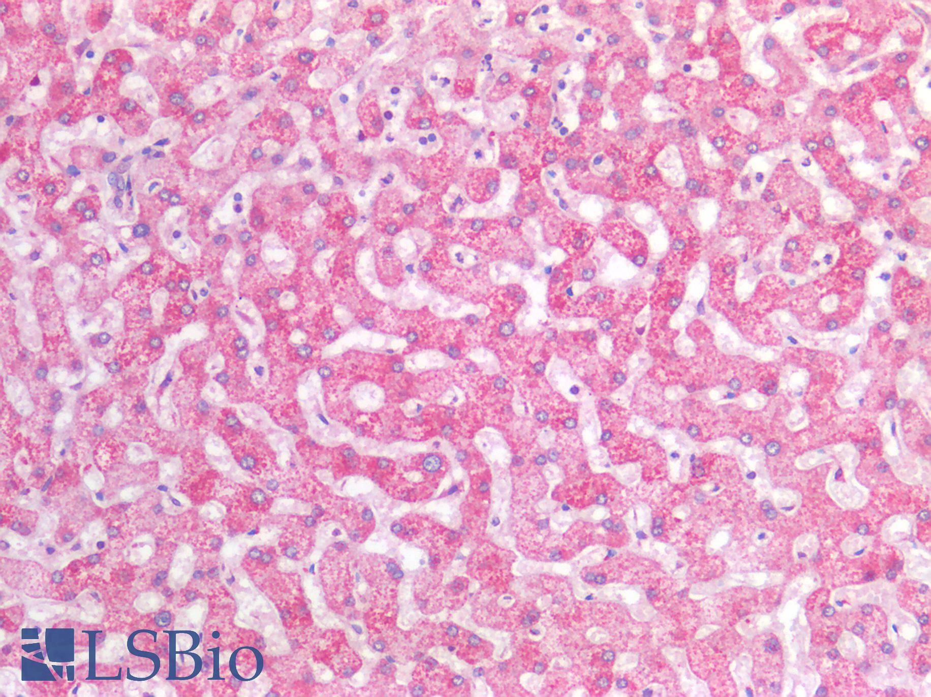SIAH2 Antibody - Human Liver: Formalin-Fixed, Paraffin-Embedded (FFPE)
