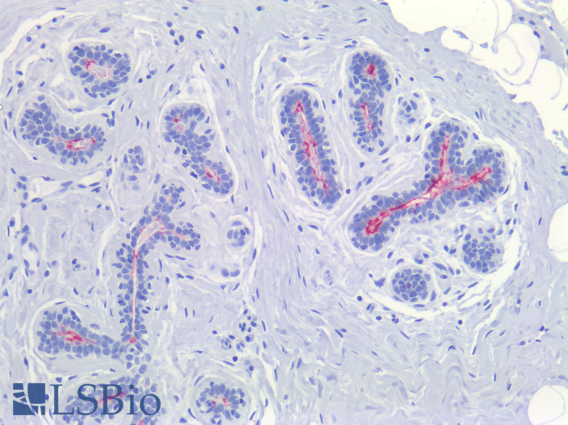 Sialylated Lewis a / CA 19-9 Antibody - Human Breast: Formalin-Fixed, Paraffin-Embedded (FFPE)