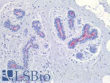 Sialylated Lewis a / CA 19-9 Antibody - Human Breast: Formalin-Fixed, Paraffin-Embedded (FFPE)