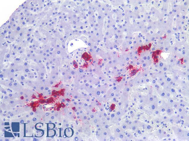 Sialylated Lewis a / CA 19-9 Antibody - Human Liver: Formalin-Fixed, Paraffin-Embedded (FFPE)