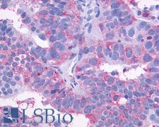 SIPR3 / EDG3 / S1P3 Antibody - Ovary, Carcinoma