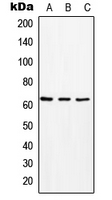 SLC16A2 / MCT8 Antibody - Western blot analysis of MCT8 expression in HeLa (A); Raw264.7 (B); rat kidney (C) whole cell lysates.