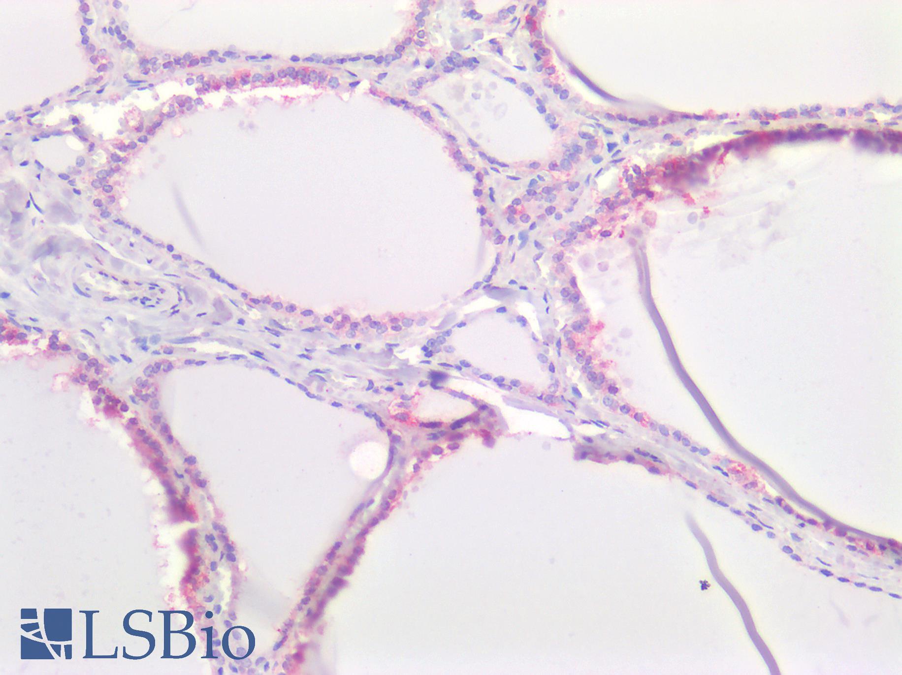 SLC16A2 / MCT8 Antibody - Human Thydoid: Formalin-Fixed, Paraffin-Embedded (FFPE)