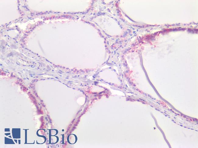 SLC16A2 / MCT8 Antibody - Human Thydoid: Formalin-Fixed, Paraffin-Embedded (FFPE)