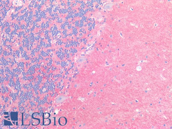 SLC1A2 / EAAT2 / GLT-1 Antibody - Human Brain, Cerebellum: Formalin-Fixed, Paraffin-Embedded (FFPE)