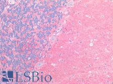 SLC1A2 / EAAT2 / GLT-1 Antibody - Human Brain, Cerebellum: Formalin-Fixed, Paraffin-Embedded (FFPE)