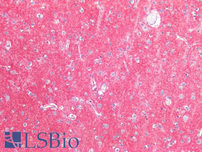 SLC1A2 / EAAT2 / GLT-1 Antibody - Human Brain, Cortex: Formalin-Fixed, Paraffin-Embedded (FFPE)