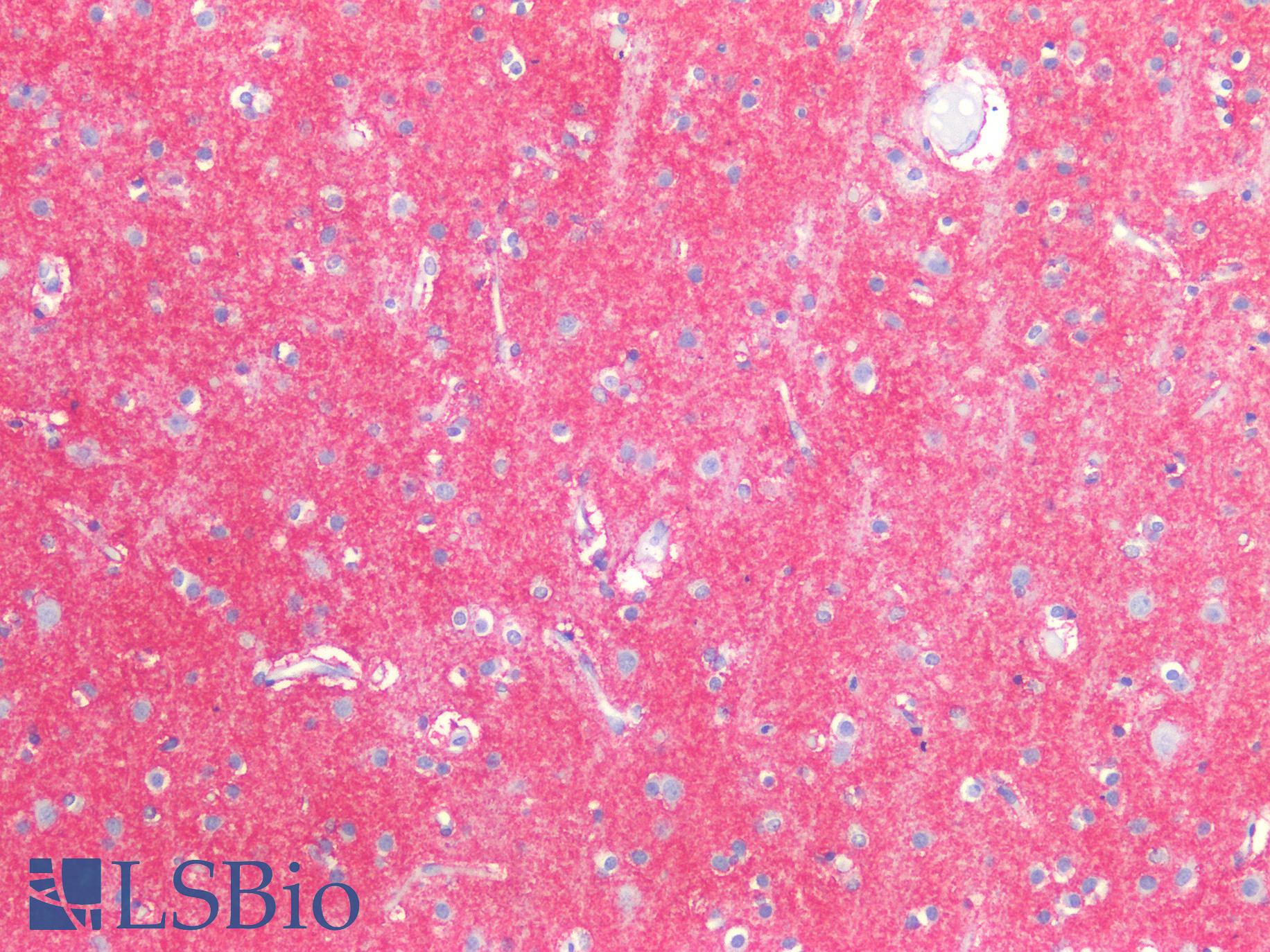SLC1A2 / EAAT2 / GLT-1 Antibody - Human Brain, Cortex: Formalin-Fixed, Paraffin-Embedded (FFPE)