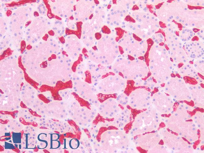 SLC2A1 / GLUT-1 Antibody - Human Kidney: Formalin-Fixed, Paraffin-Embedded (FFPE)