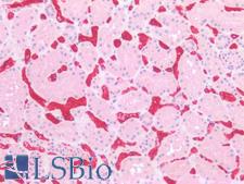 SLC2A1 / GLUT-1 Antibody - Human Kidney: Formalin-Fixed, Paraffin-Embedded (FFPE)