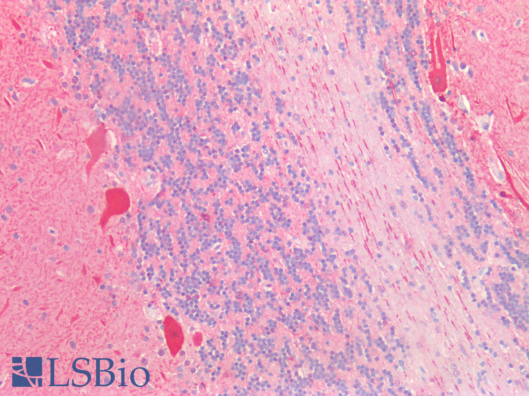 SLC2A13 / HMIT / GLUT13 Antibody - Human Brain, Cerebellum: Formalin-Fixed, Paraffin-Embedded (FFPE)