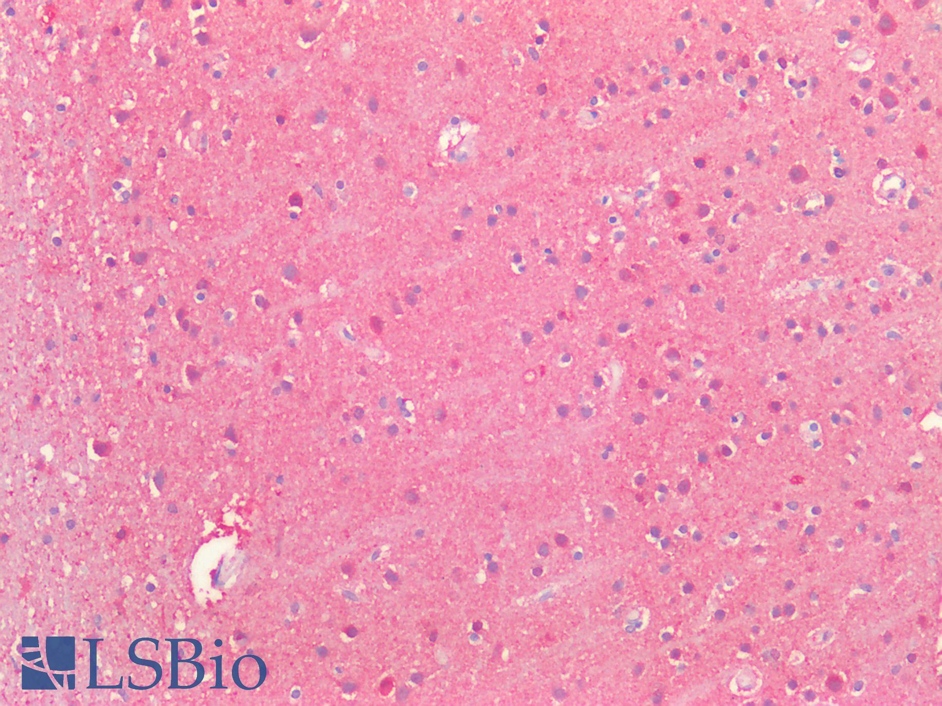 SLC2A13 / HMIT / GLUT13 Antibody - Human Brain, Cortex: Formalin-Fixed, Paraffin-Embedded (FFPE)