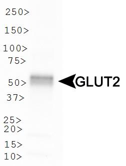 SLC2A2 / GLUT2 Antibody - Western Blot: Glucose Transporter GLUT2 Antibody - WB analysis of Glucose Transporter GLUT2 in human pancreas.