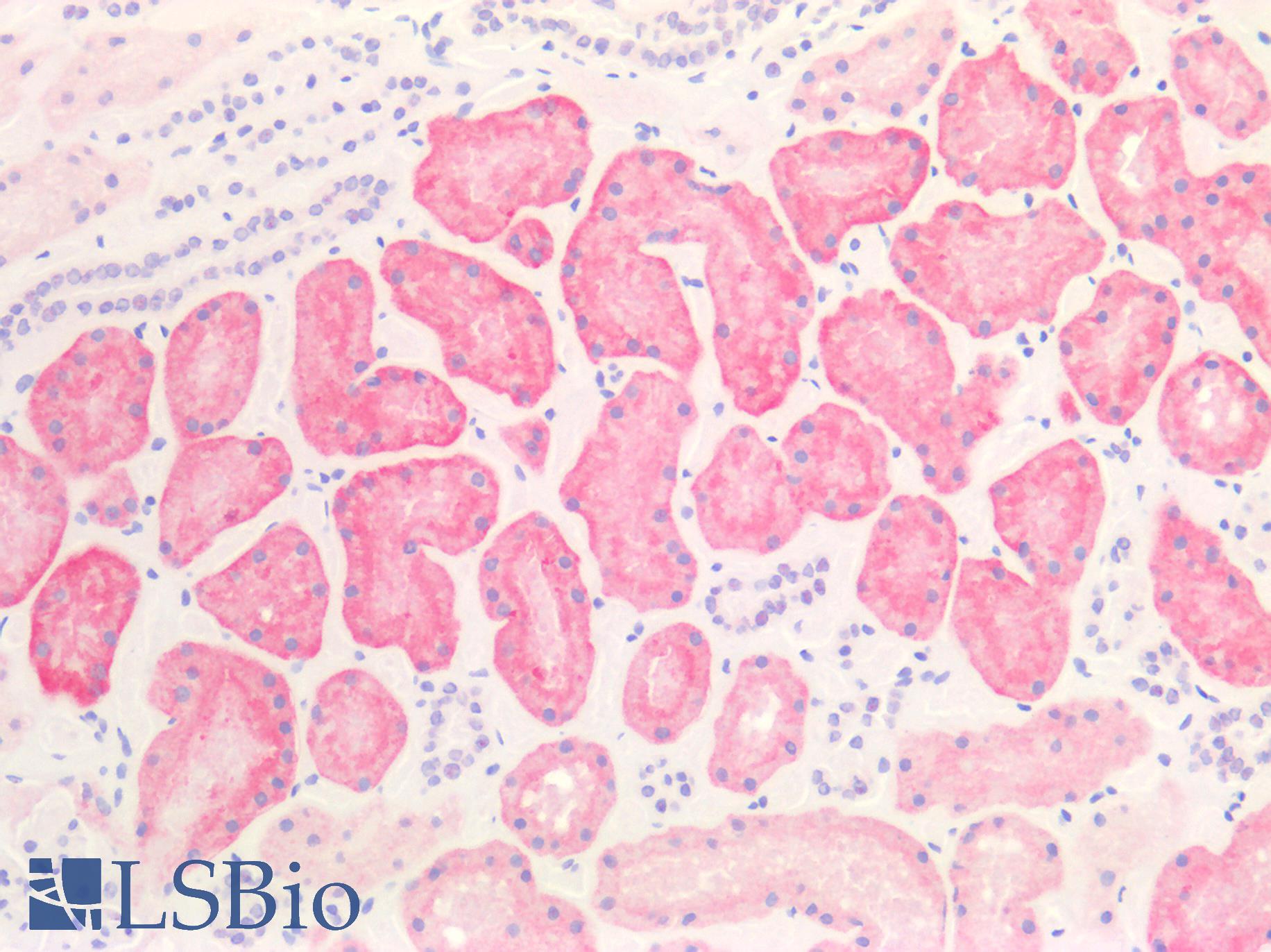 SLC2A2 / GLUT2 Antibody - Human Kidney: Formalin-Fixed, Paraffin-Embedded (FFPE)